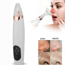 Aparelho Removedor De Cravos E Espinhas À Vácuo Com 3 pontas Remoção Eletrônica de Cravos - BrazilStory