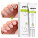 Creme anti fúngico para Unhas - Efero - BrazilStory
