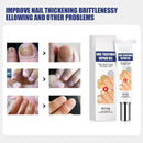 Creme da remoção de fungo, Tratamento do pé, Anti-infecção, Anti-Fungal, Onychomycosis, Paronychia - BrazilStory