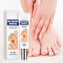 Creme da remoção de fungo, Tratamento do pé, Anti-infecção, Anti-Fungal, Onychomycosis, Paronychia - BrazilStory