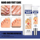 Creme da remoção de fungo, Tratamento do pé, Anti-infecção, Anti-Fungal, Onychomycosis, Paronychia - BrazilStory